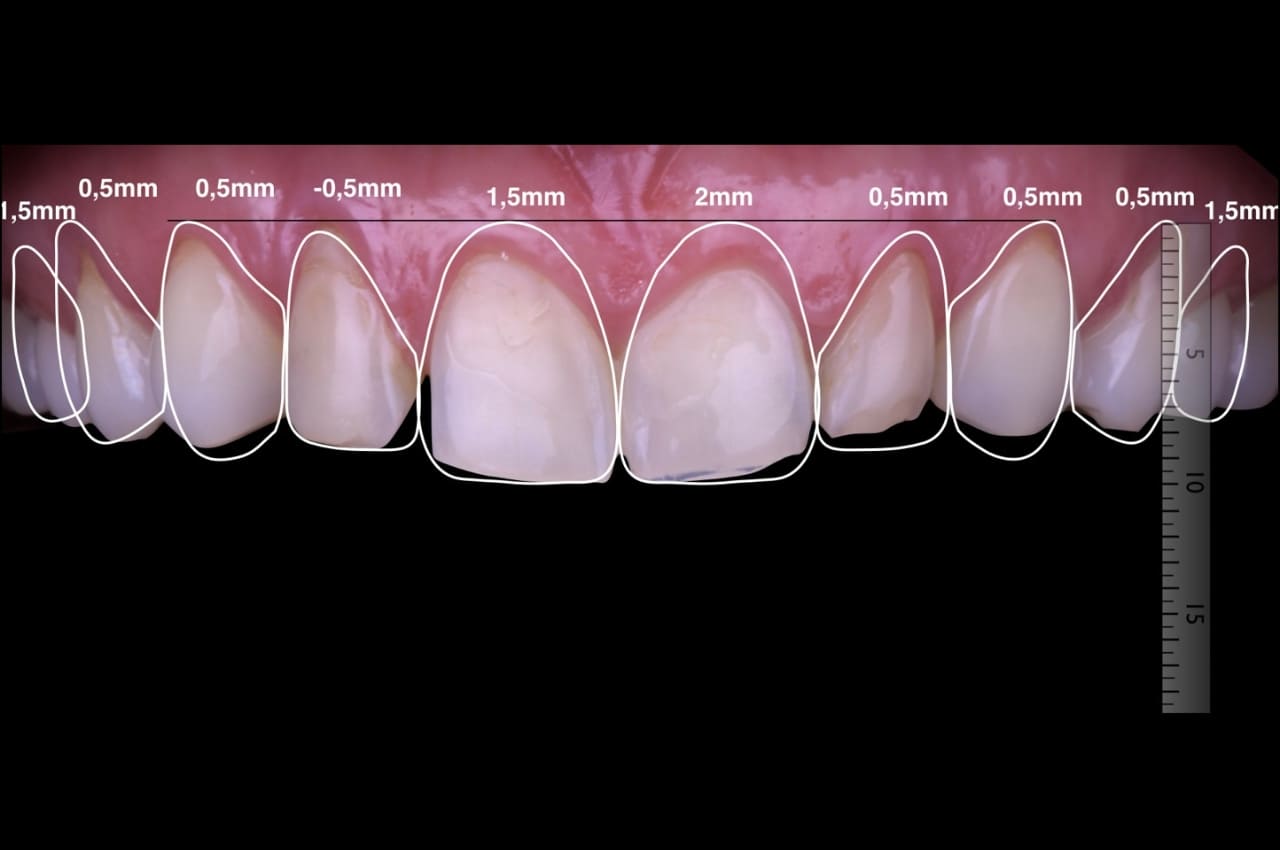 Estética Dental