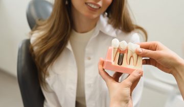 Conoce cuál es el implante dental que necesitas