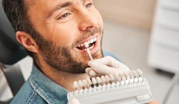 ¿Qué son las carillas dentales y para qué sirven?